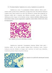 Antibiotikų poveikis mikroorganizmams 13 puslapis