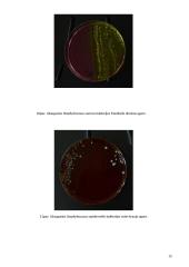 Antibiotikų poveikis mikroorganizmams 15 puslapis