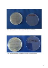 Antibiotikų poveikis mikroorganizmams 16 puslapis