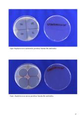 Antibiotikų poveikis mikroorganizmams 17 puslapis