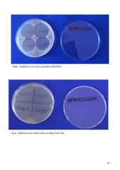 Antibiotikų poveikis mikroorganizmams 18 puslapis