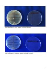 Antibiotikų poveikis mikroorganizmams 19 puslapis