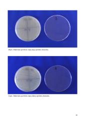 Antibiotikų poveikis mikroorganizmams 20 puslapis