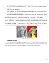 Skaitmeninių vaizdų segmentavimo paskirtis ir algoritmai 4 puslapis
