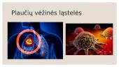 ﻿Kodėl ląstelės virsta vėžinėmis? 7 puslapis