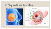 ﻿Kodėl ląstelės virsta vėžinėmis? 8 puslapis