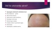 Aknė arba jaunatviniai spuogai 5 puslapis