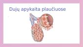 ﻿Dujų apykaita plaučiuose ir audiniuose 4 puslapis