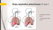 Dujų apykaita plaučiuose, kvėpavimo dujų pernaša ir dujų apykaita audiniuose 3 puslapis