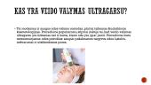 Veido valymas ultragarsu 2 puslapis