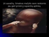 Unikali gyvybės vystymosi istorija 20 puslapis