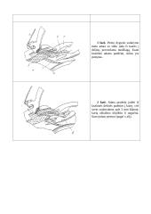 Grandininio (kilpiklinio) dygsnio sudarymo procesas 6 puslapis