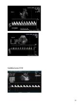 Vaisiaus augimo sulėtėjimas 10 puslapis