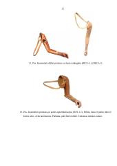 Rankų protezinė sistema: galimybės ir ypatumai 12 puslapis