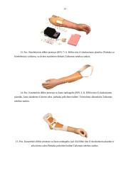 Rankų protezinė sistema: galimybės ir ypatumai 13 puslapis