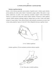 Rankų protezinė sistema: galimybės ir ypatumai 14 puslapis