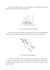 Rankų protezinė sistema: galimybės ir ypatumai 15 puslapis