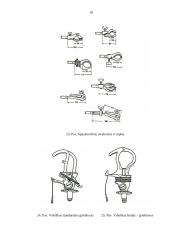 Rankų protezinė sistema: galimybės ir ypatumai 18 puslapis