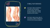 Vaikų nutukimas 4 puslapis