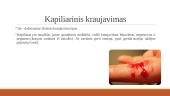 Išorinis, vidinis viešas ir slaptas kraujavimas 4 puslapis