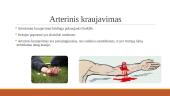 Išorinis, vidinis viešas ir slaptas kraujavimas 6 puslapis