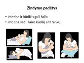 Kūdikių maitinimas: žindymas arba natūralus maitinimas, maitinimas pro zondą 15 puslapis