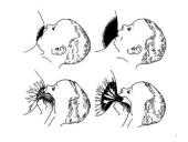 Kūdikių maitinimas: žindymas arba natūralus maitinimas, maitinimas pro zondą 17 puslapis