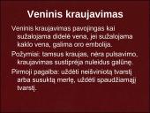 Kraujavimo rūšys ir pirmoji pagalba 5 puslapis