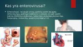 Enterovirusinės infekcijos 2 puslapis