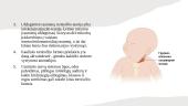Torticollis (kreivakaklystė) 4 puslapis
