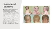 Torticollis (kreivakaklystė) 5 puslapis