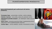 Kas yra plokščiapėdystė? 12 puslapis