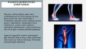 Kas yra plokščiapėdystė? 18 puslapis
