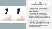 Kas yra plokščiapėdystė? 3 puslapis