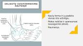 Kas yra plokščiapėdystė? 6 puslapis