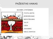 Nepatogus jaunimas – bausti ar pasigailėti? 10 puslapis