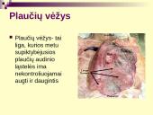 Vėžys - nekontroliuojamas ląstelių dalijimasis 14 puslapis