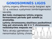 Paveldimos ligos 5 puslapis