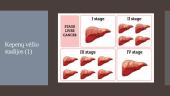 Kepenų vėžys 12 puslapis