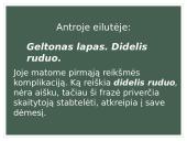 Henriko Radausko eilėraščio „Fontanas“ analizė 7 puslapis