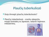 Kvėpavimo organų ligos ir jų atitolinimų būdai 10 puslapis