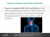 Reabilitacija po nugaros smegenų pažeidimo 10 puslapis