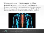 Reabilitacija po nugaros smegenų pažeidimo 11 puslapis