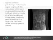 Reabilitacija po nugaros smegenų pažeidimo 9 puslapis