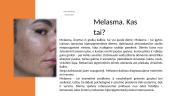 Melasma. Kas tai? 2 puslapis