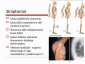 Osteoperozės profilaktikai ir gydymui vartojamų vaistų farmakologinių savybių apžvalga 18 puslapis