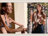 Apie anoreksiją 11 puslapis