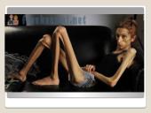 Apie anoreksiją 13 puslapis