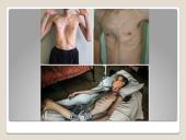 Apie anoreksiją 8 puslapis