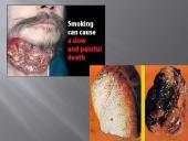 Rūkyti kieta gi! 4 puslapis